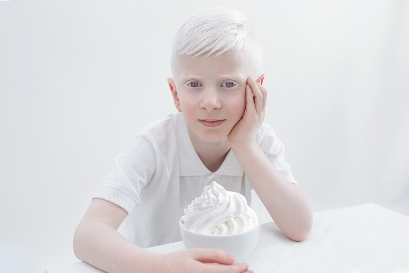 Yulia Taits Captures The Pure Natural Beauty of Albinism in Porcelain Beauty 2